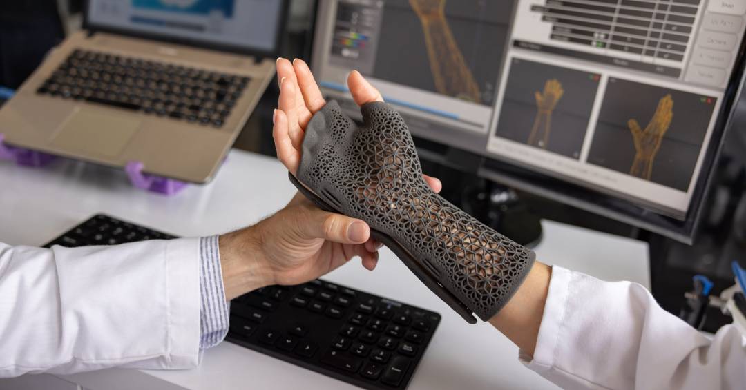 Será o fim do gesso? Ortopedia entra na era 3D para personalização