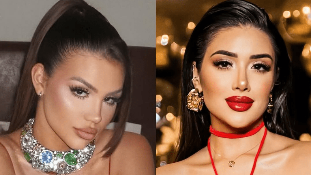 Juliano Floss vê semelhança entre ex e sister por procedimentos: “Trauma”