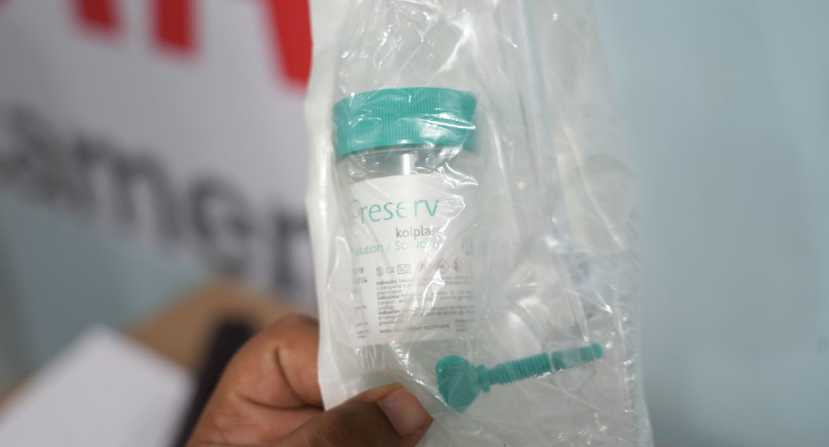 Porto Velho oferece exame DNA-HPV para detecção precoce de câncer na rede municipal