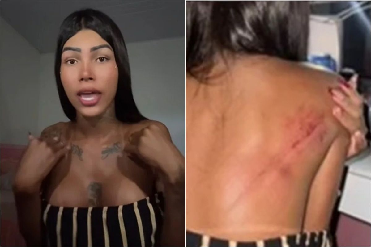 Garota de programa é agredida por esposa de cliente em motel…