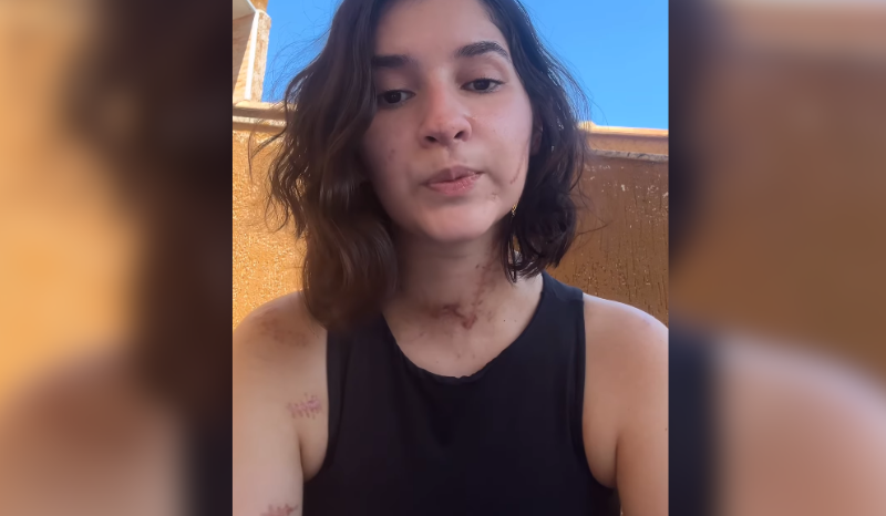 jovem esfaqueada por recusar namoro se pronuncia pela primeira vez