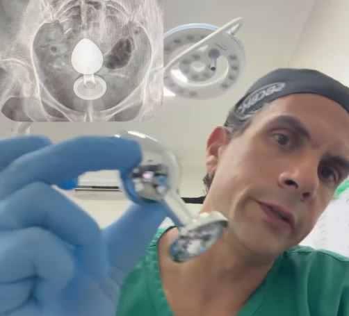 VÍDEO: médico alerta para brincadeiras arriscadas: “amarre seu brinquedinho”