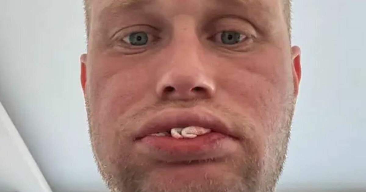Homem perde todos os dentes após passar por tratamento na Turquia