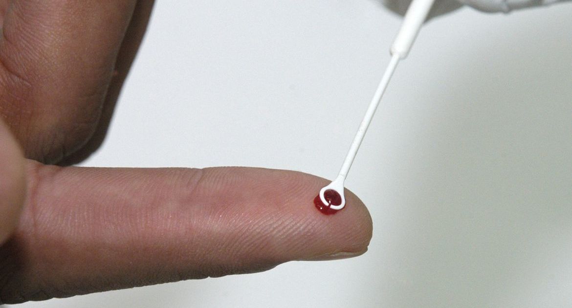 Comissão discute uso de medicamento no SUS para prevenção ao HIV