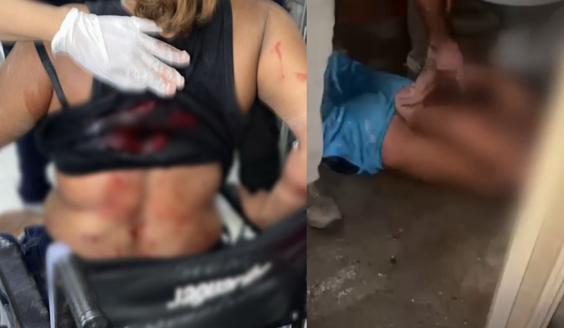 bêbado, marido agride com socos e desfere facadas em mulher no AM