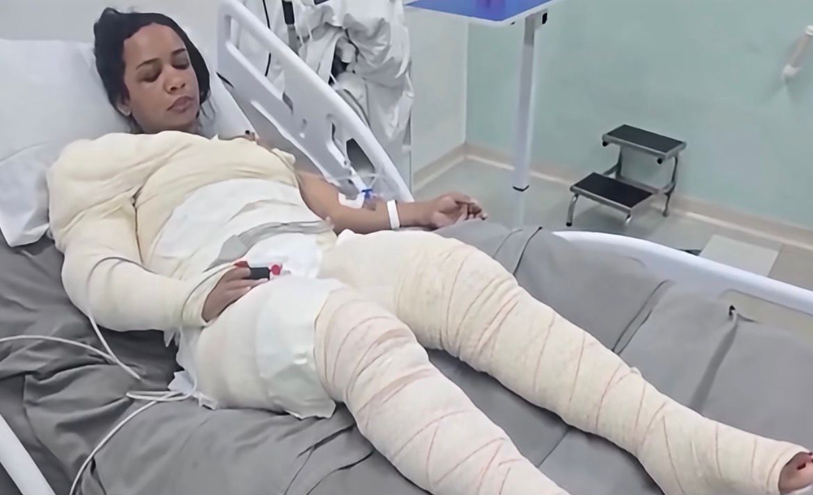 Mulher denunciou o ex por ataque com fogo antes de morrer em hospital