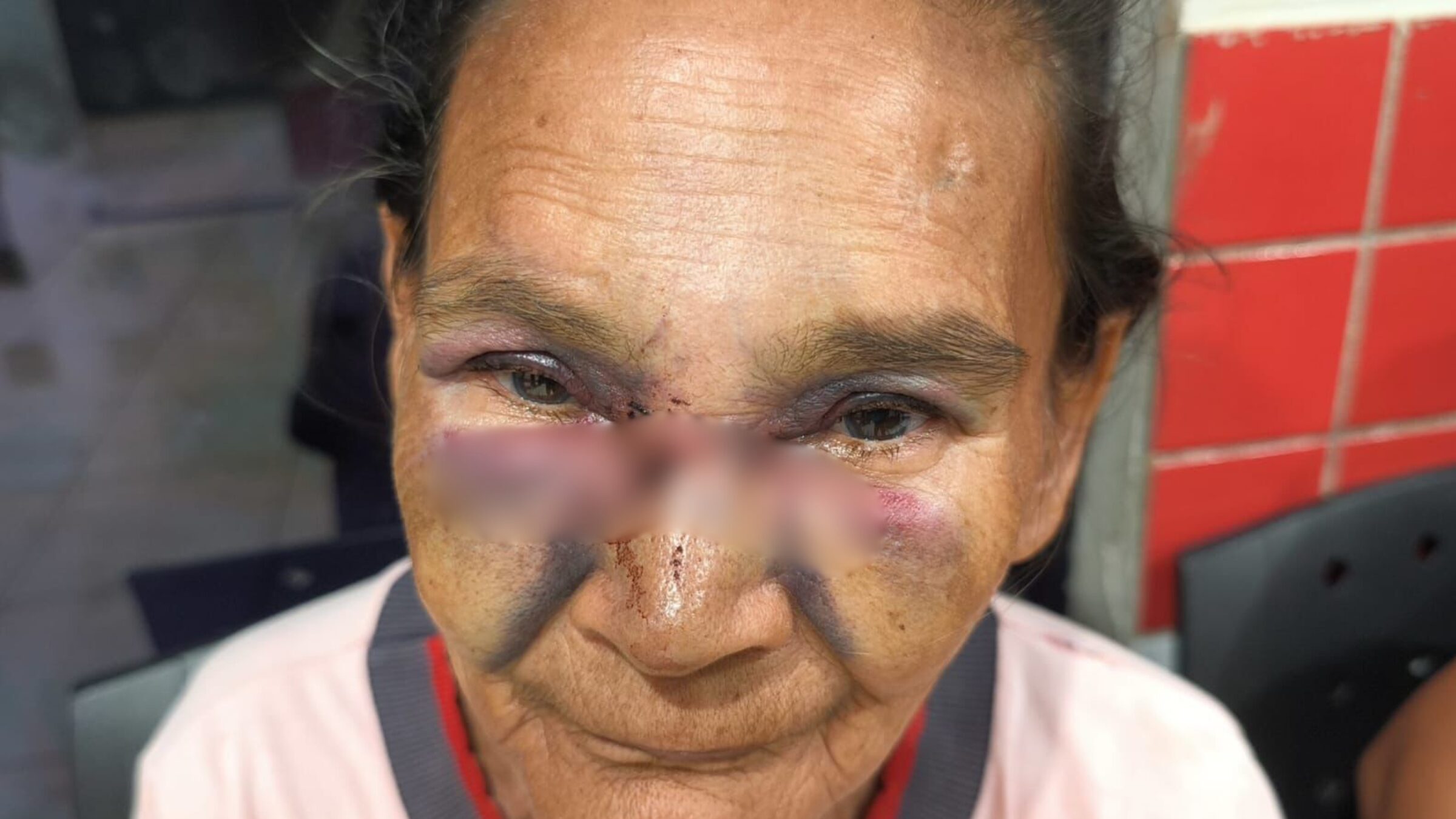 Agressão covarde: idosa de 68 anos é espancada e filho é investigado por omissão