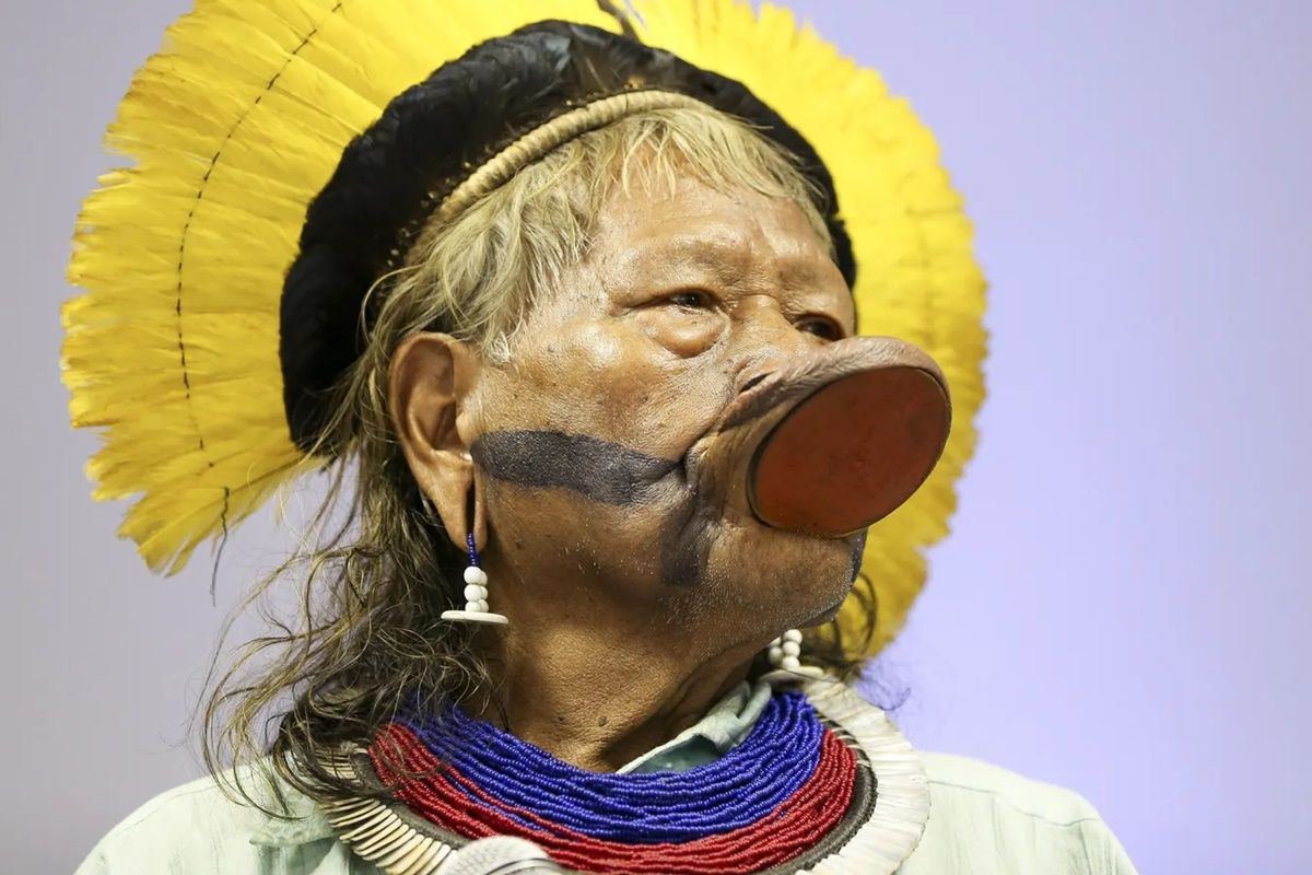 Cacique Raoni recebe alta após diagnóstico de hérnia diafragmática…