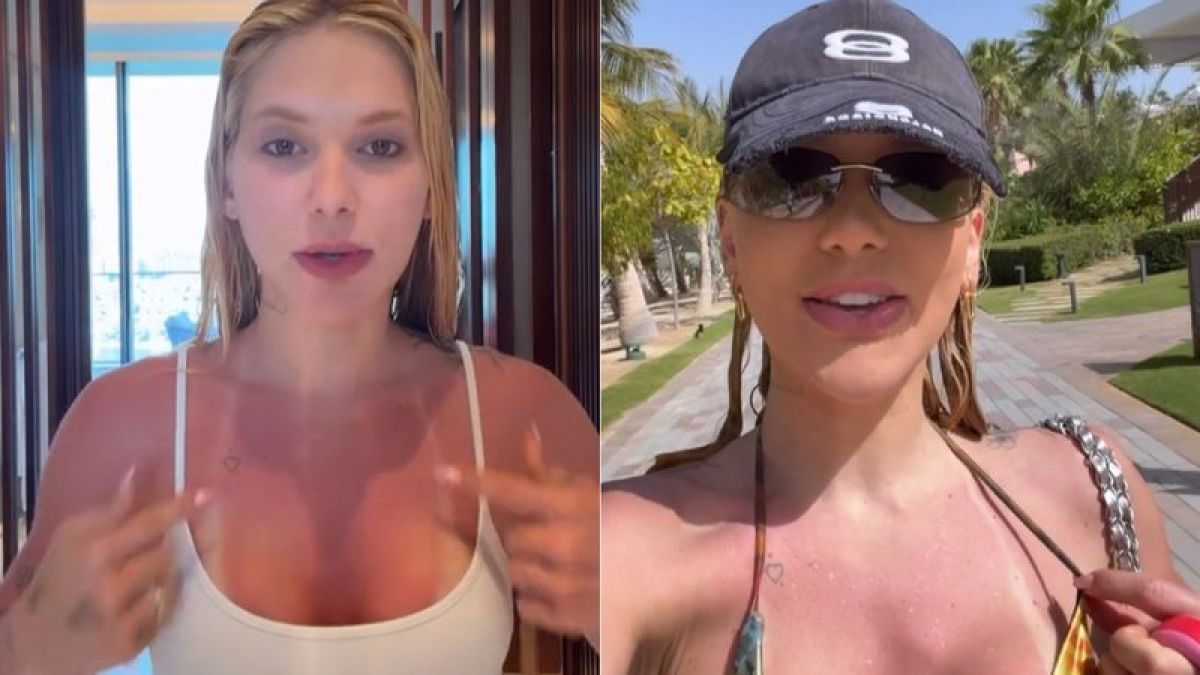 Virginia Fonseca mostra pele queimada após dia de sol em Dubai…
