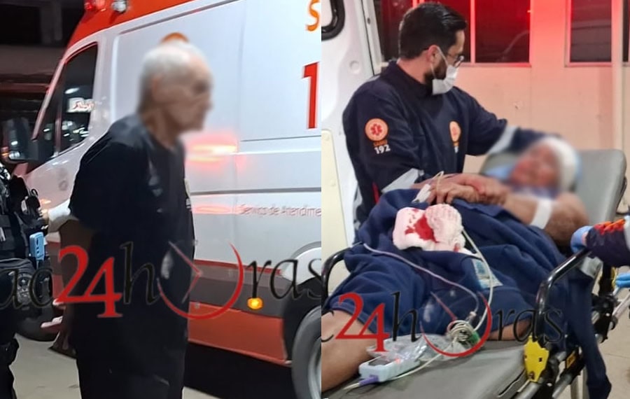 Briga entre casal deixa dois feridos a golpes de tesoura em Rio Branco