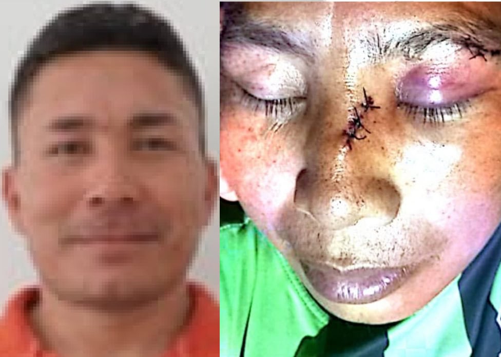 Vereador agride homem a socos após partida de futebol em aldeia indígena no interior do Acre