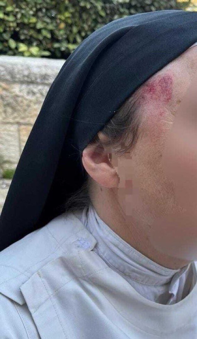 Polícia de Israel divulga vídeo de ataque contra freira em Jerusalém