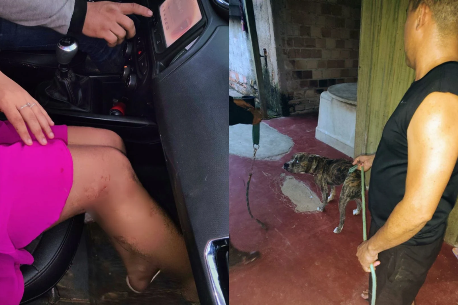 Mulher é atacada por pitbull ao tentar proteger crianças no sul do Pará