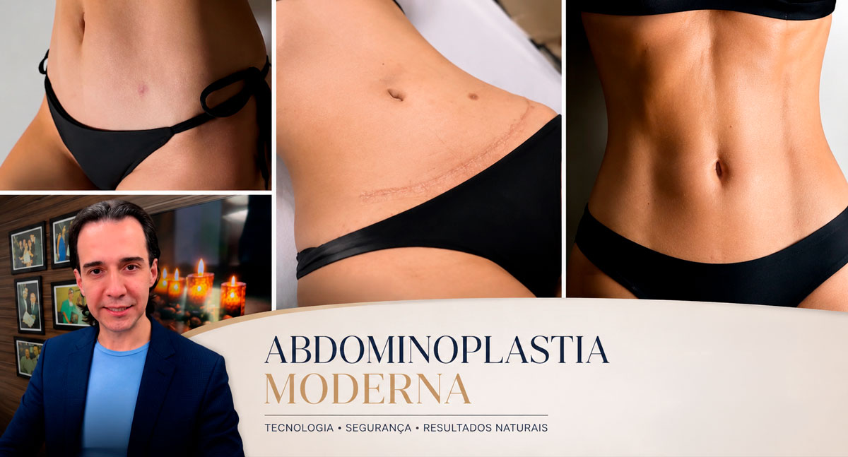 Dr. Marcelo Almeida: abdominoplastia moderna devolve confiança e redefine o corpo