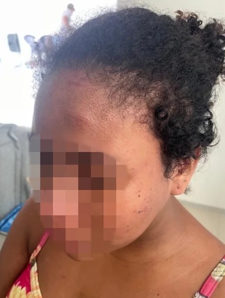 “Minha preocupação era o meu filho”, diz doméstica agredida por patroa na Grande São Luís
