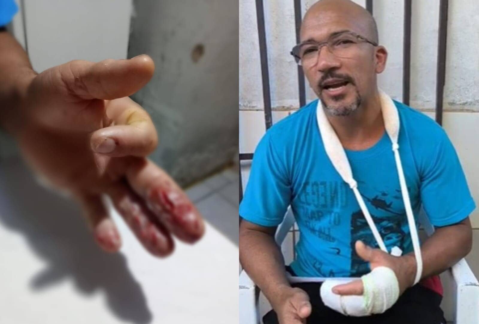 “Feliz por não ter perdido meus dedos”, diz açougueiro que ficou com a mão presa em amaciador de carne em Rio Branco