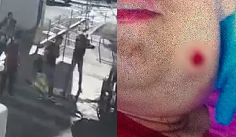 suspeito atira em jovem autista após questionar por que ela estaria rindo