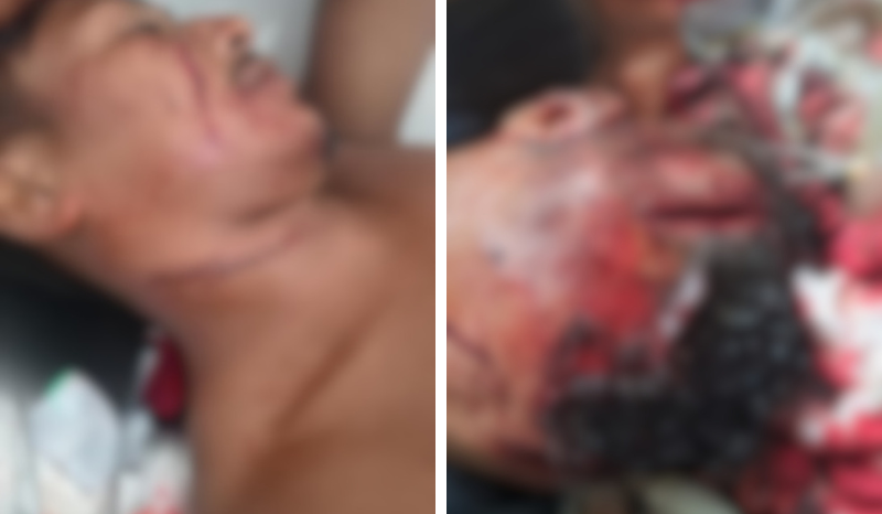 homens bêbados duelam com facão e pedaço de madeira