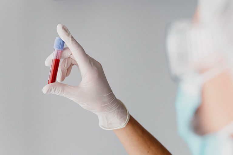 infectologista explica transmissão, sintomas e prevenção