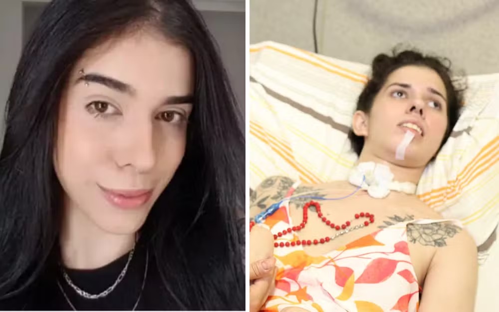 Jovem que teve reação após cheirar pimenta volta à UTI