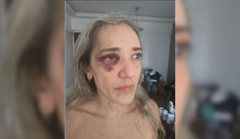 Passageira denuncia agressão de motociclista após desistir de corrida