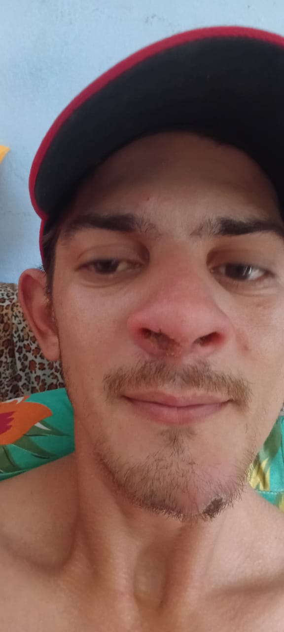 Família realiza rifa para custear tratamento de jovem