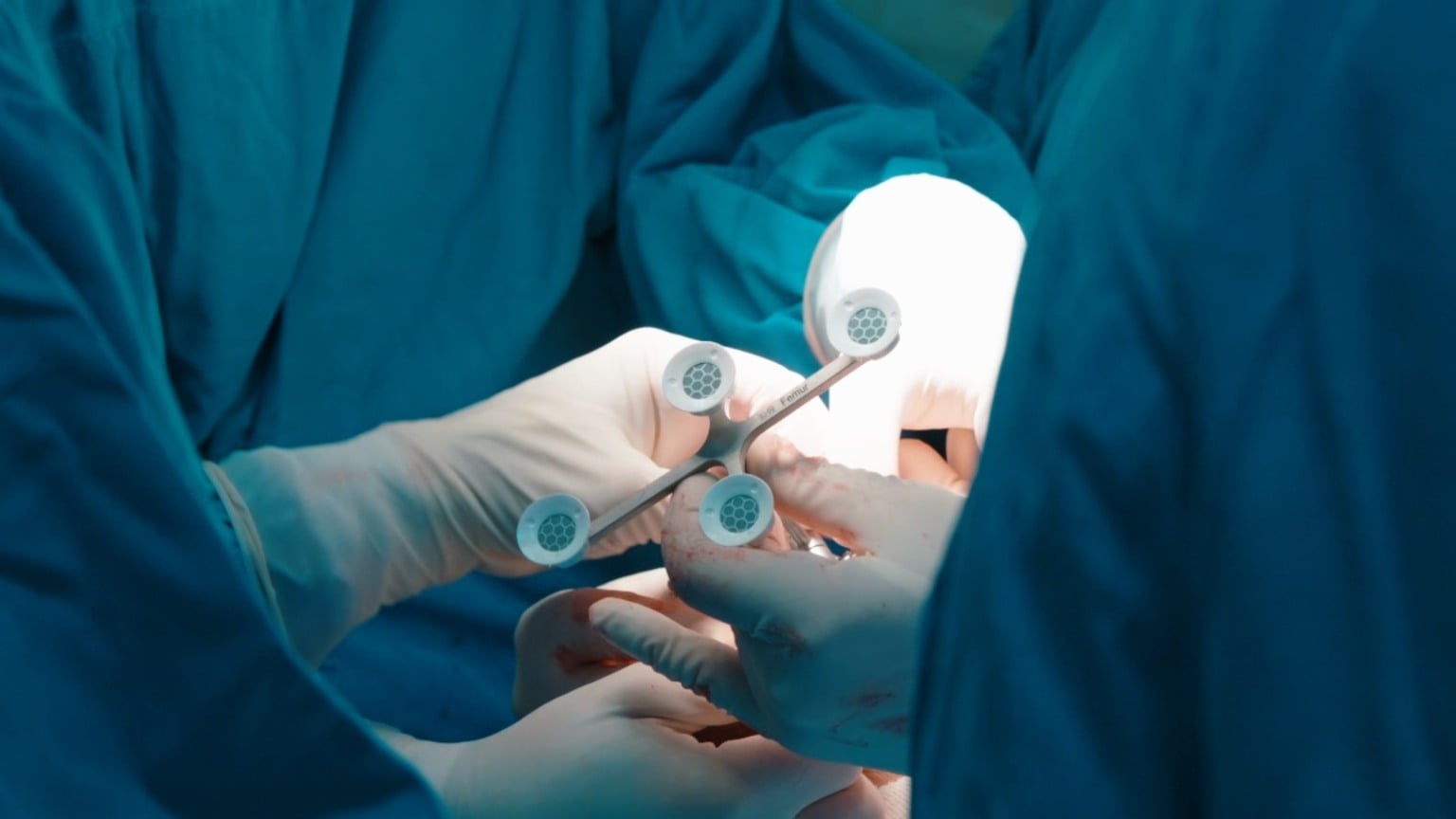 Brasil realiza primeira cirurgia ortopédica robótica com tecnologia chinesa