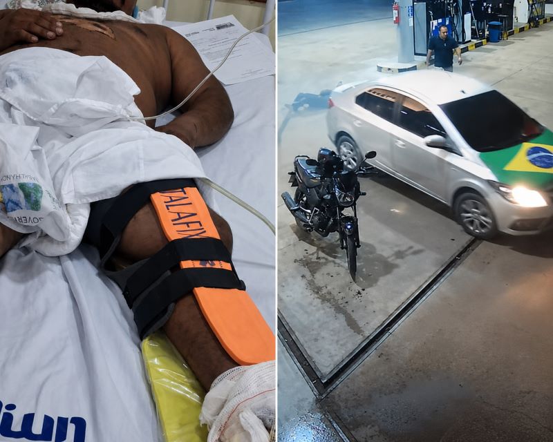 Polícia busca por motorista que atropelou vidraceiro 5 vezes; vítima passa por cirurgia – SelesNafes.com