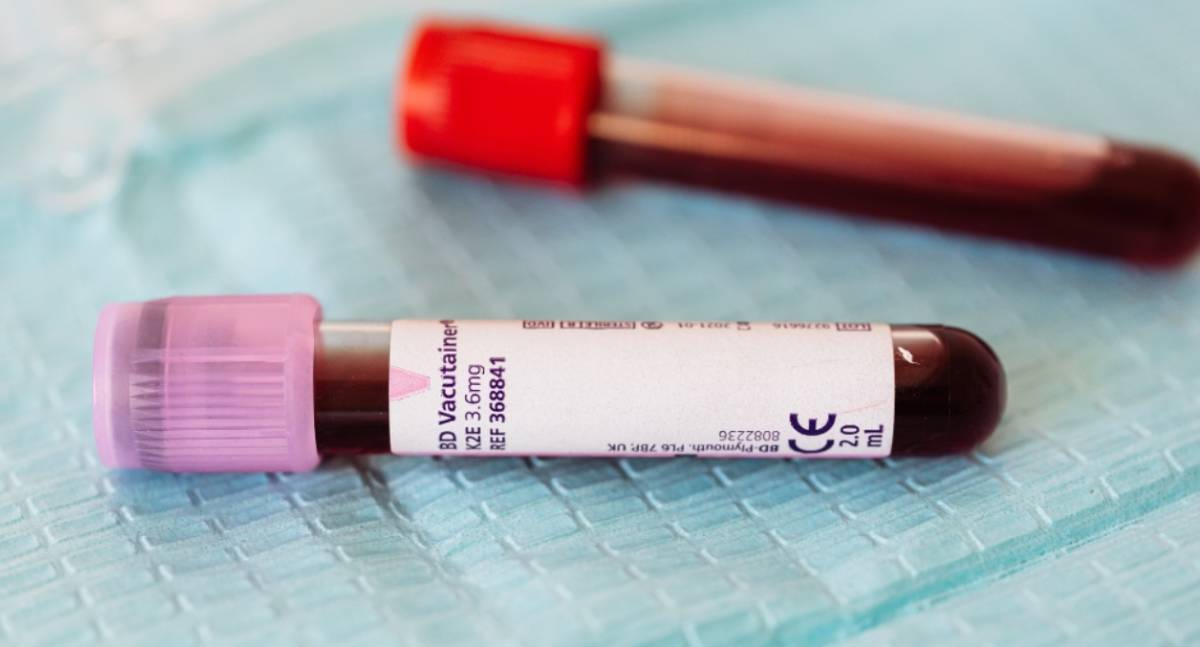Tratamento de leucemia no SUS ganha reforço com incorporação de novo medicamento combinado